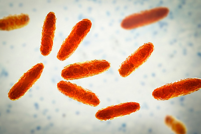 Gramnegative Stäbchenbakterien: Klebsiella pneumoniae